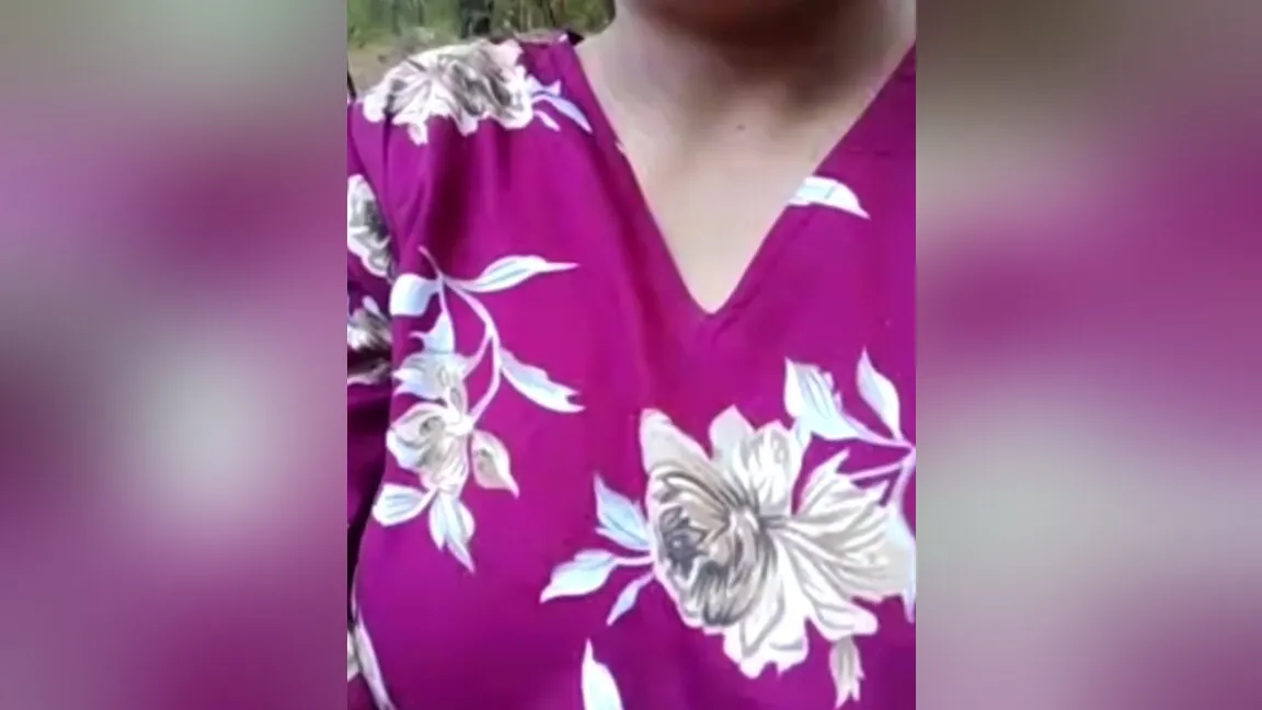 Sexy Girl Outdoor Park Boobs Press Flash