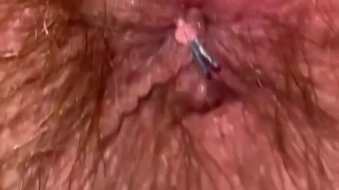 Indian Virgin Fucking Ass